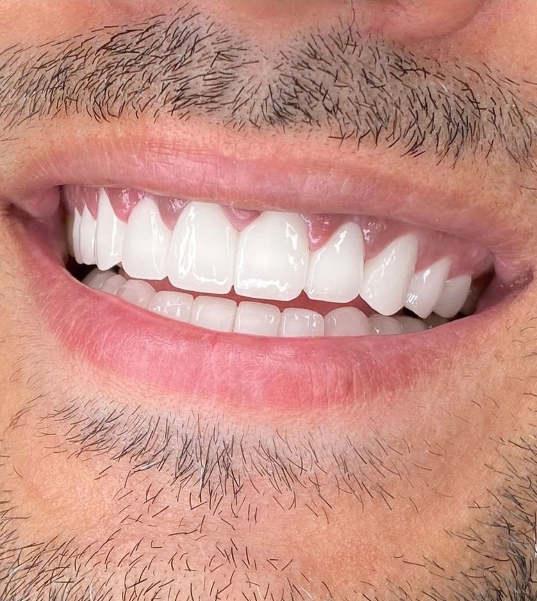 Dental Estetik Istanbul - Photo 3