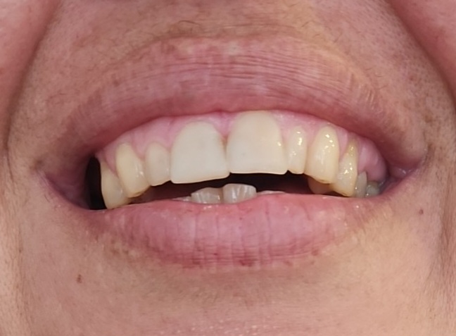 Ihlamur Dent - Photo 5