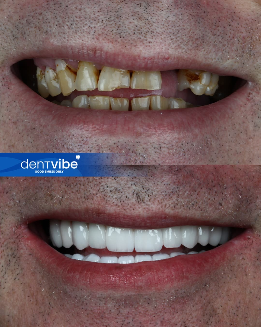 Dentvibe - Photo 3