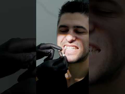 Qairy Dent Dental Clinic clinic tour