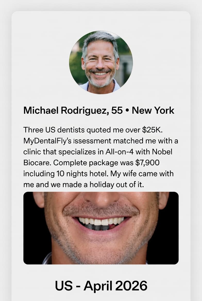 Michael Rodriguez, 55 — All-on-4 (Nobel Biocare)