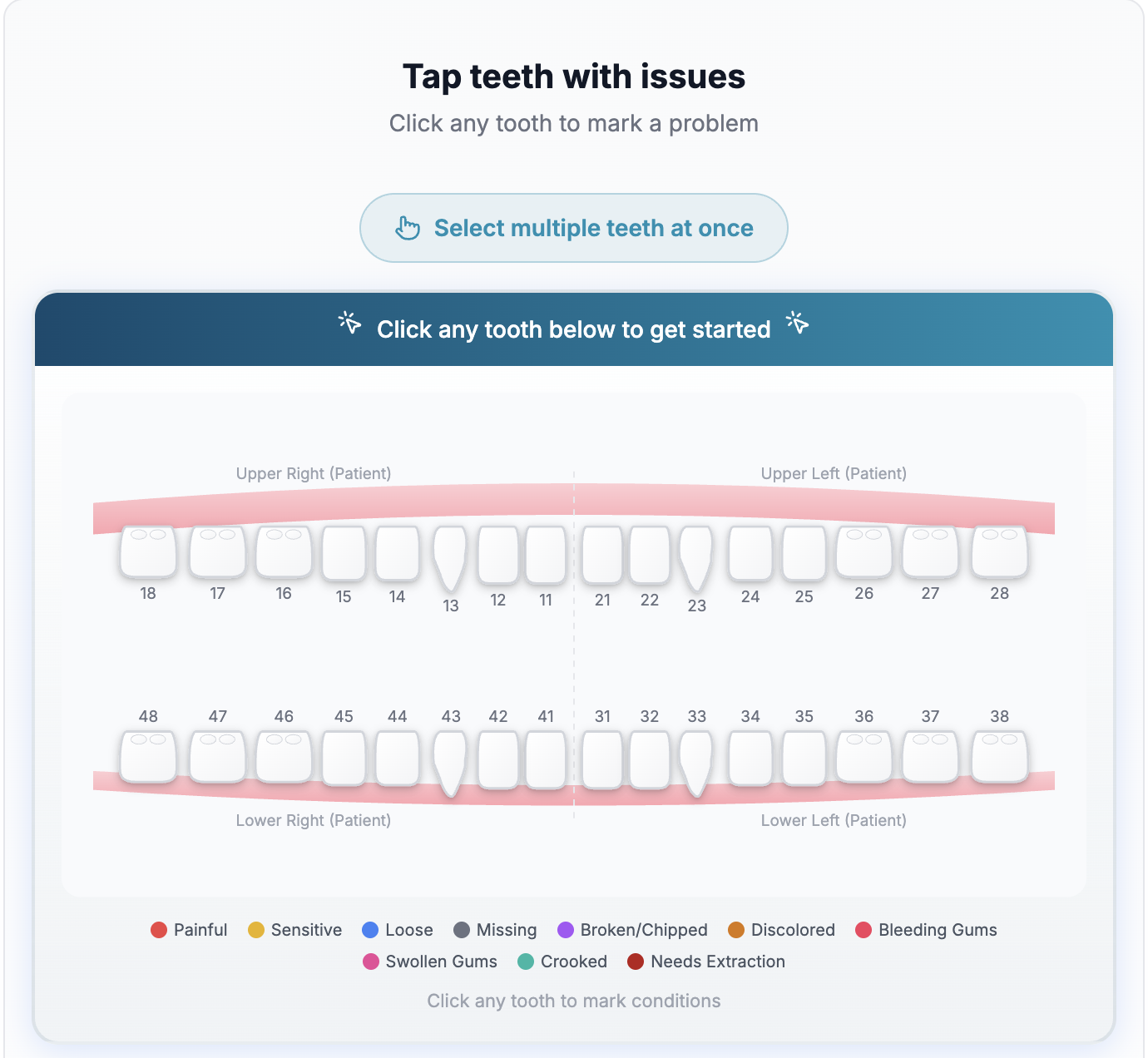 The MyDentalFly interactive dental chart shows all your upper and lower teeth. Tap any tooth to start marking issues — no dental knowledge needed.